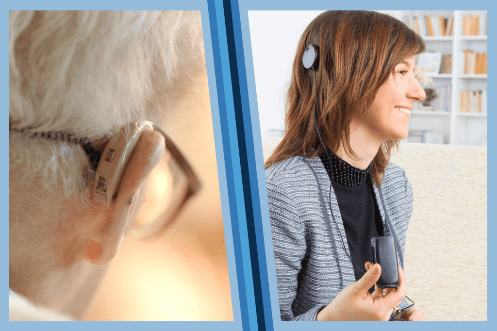 Cochlear Implants Versus Hearing Aids
