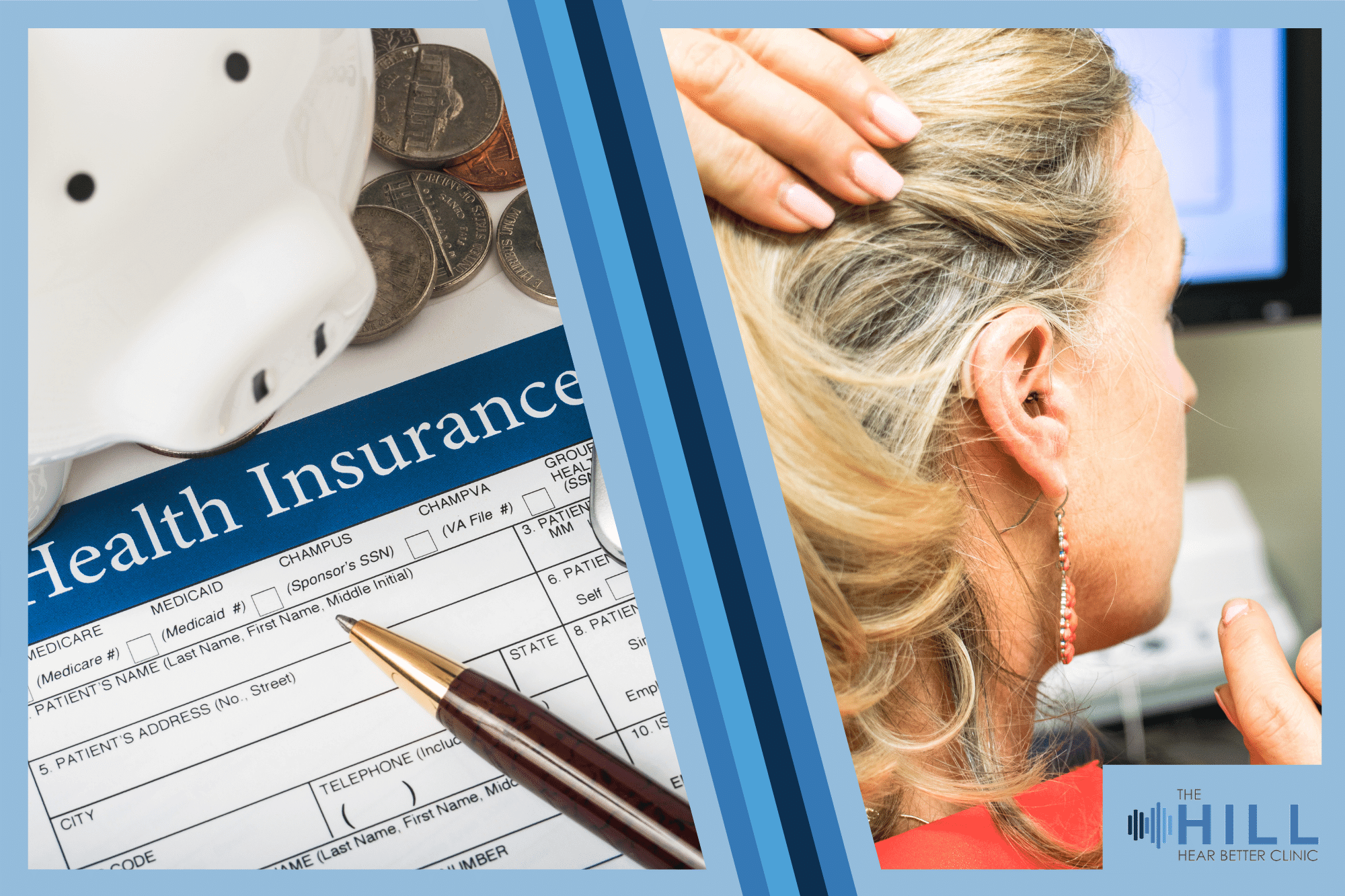 Insurance and Hearing Loss What Your Provider Won't Tell You