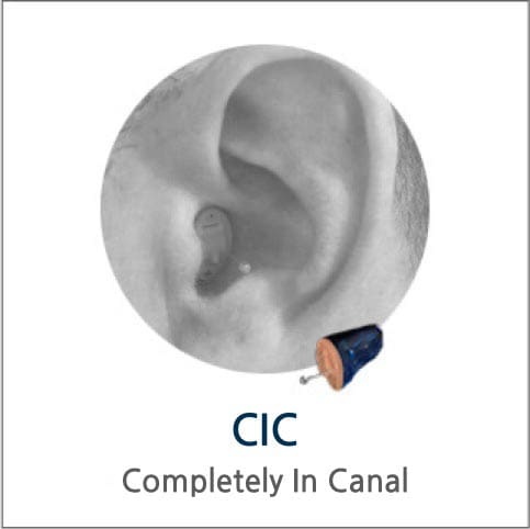 CIC - Completely In Canal